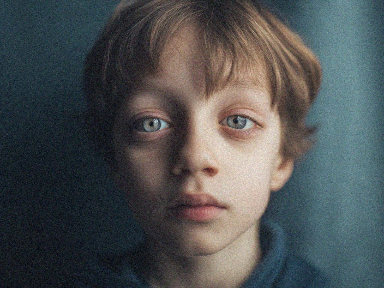 Understanding esotropia: What are the symptoms and treatments?