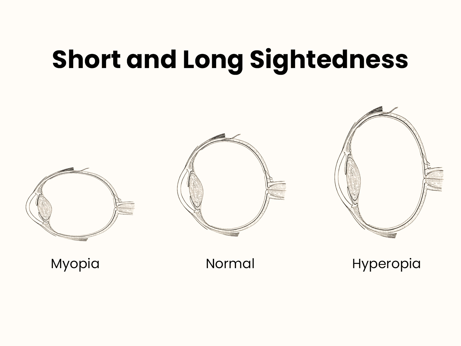 Nearsighted vs Farsighted: Everything You Need to Know