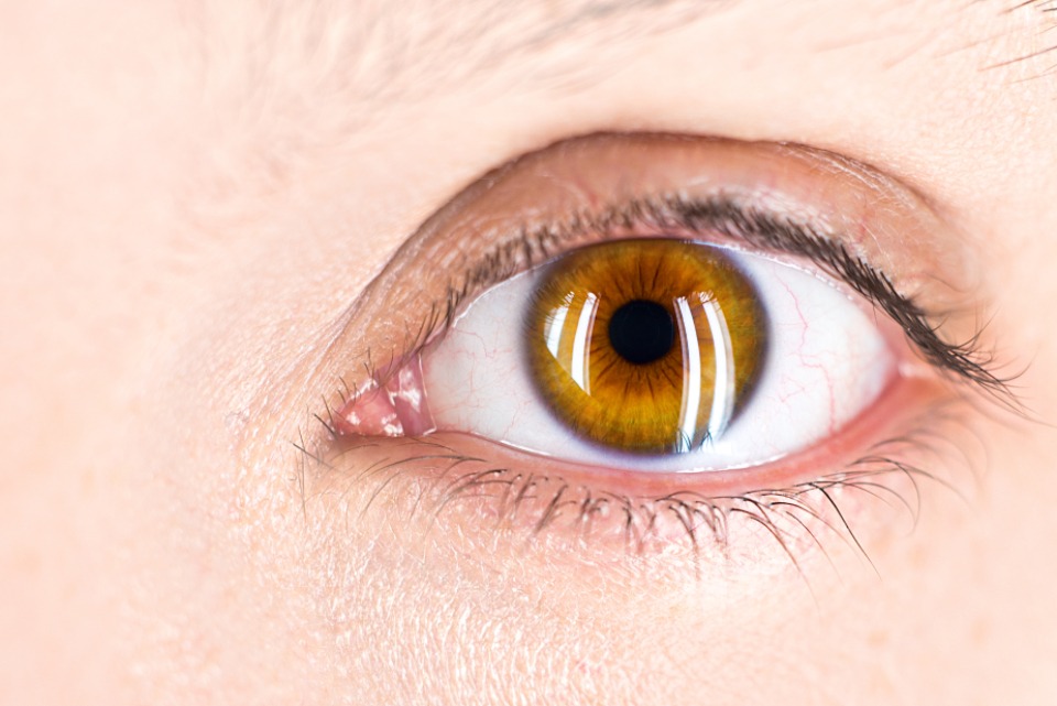 Fascinating Amber Eyes: Unveiling the Mystery
