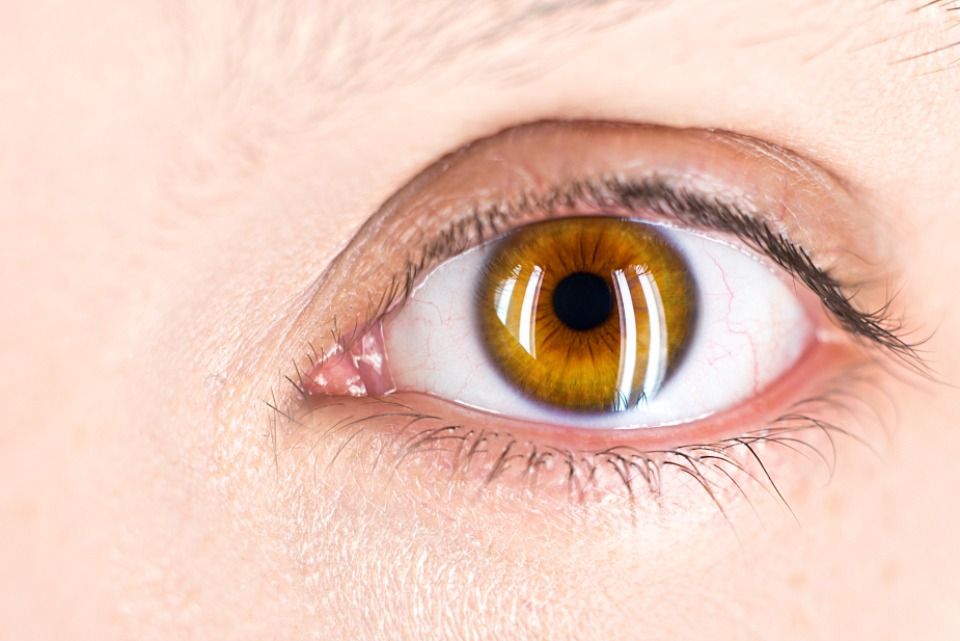 Fascinating Amber Eyes: Unveiling the Mystery
