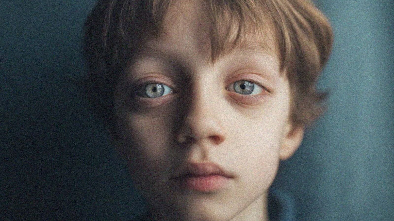 A boy with blue eyes and esotropia