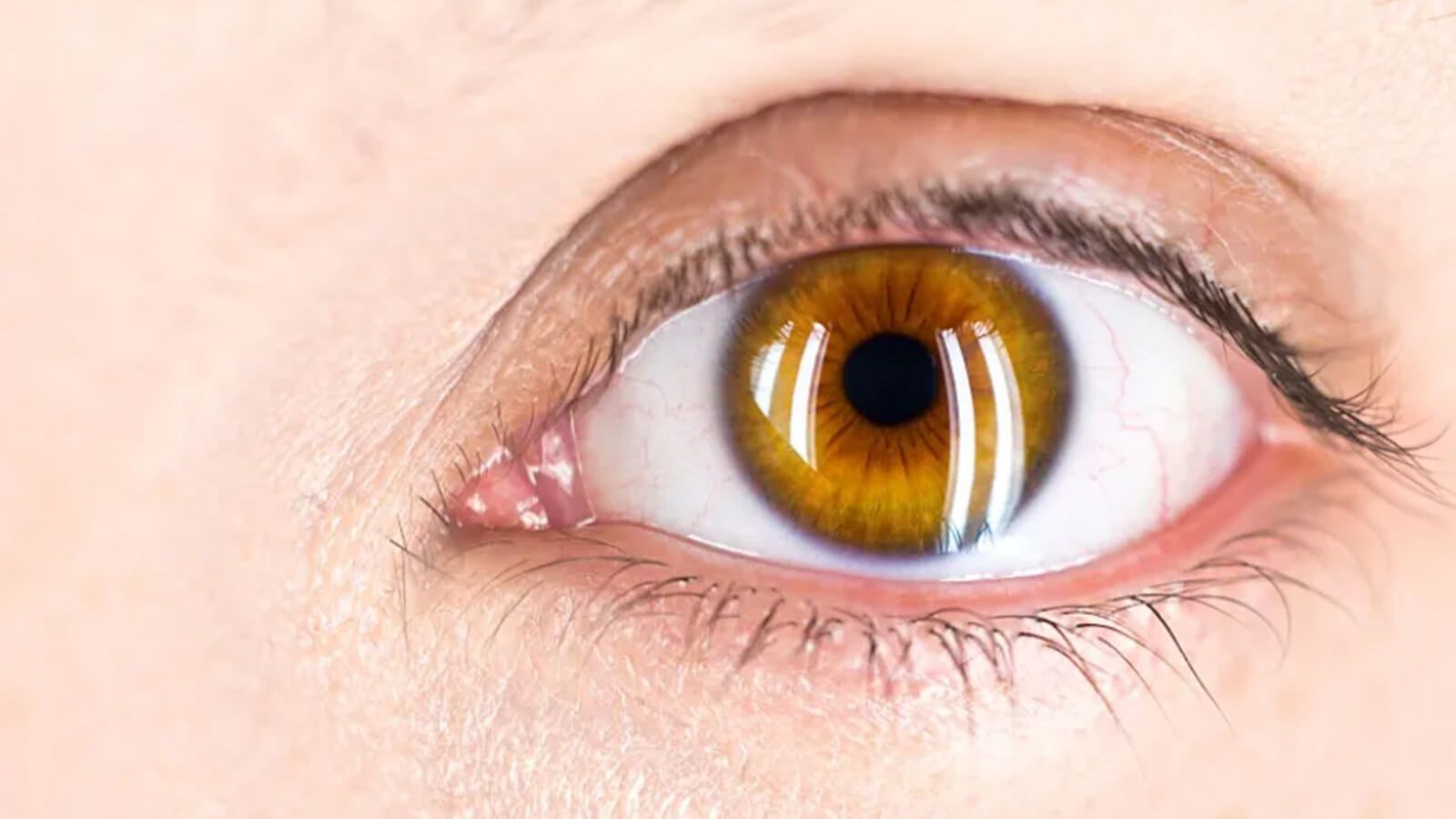 Fascinating Amber Golden Hue Eyes